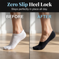 🧦❄️ Women's Low-Cut Cool Invisible Socks – Breathable, invisible, non-slip, and comfortable – Pay on Delivery ✨✅
