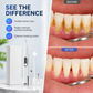 🦷 LIMITED-TIME 50% OFF ✨ Ultrasonic Teeth Cleaner & Tartar Remover — 5 Smart Modes